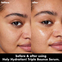 Before and After Application of Hyaluronic Serum